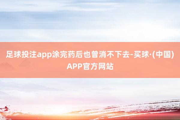 足球投注app涂完药后也曾消不下去-买球·(中国)APP官方网站